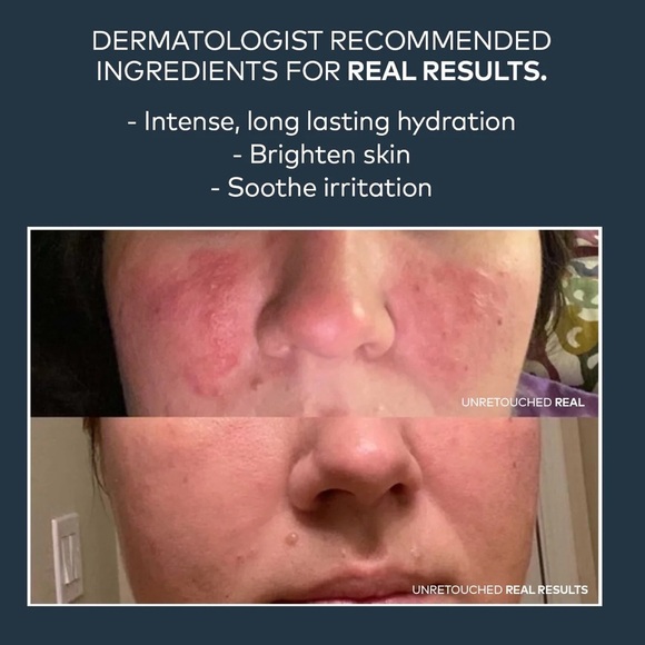 New/Sealed Onekind Dream Cream Nighttime Moisturizer - Picture 8 of 11